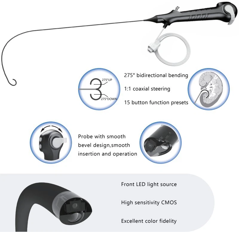 Single-use Digital Flexible Ureteroscope5
